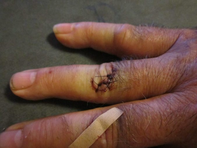 This is the damage that can be caused by an adjustable wrench and a hard head. 